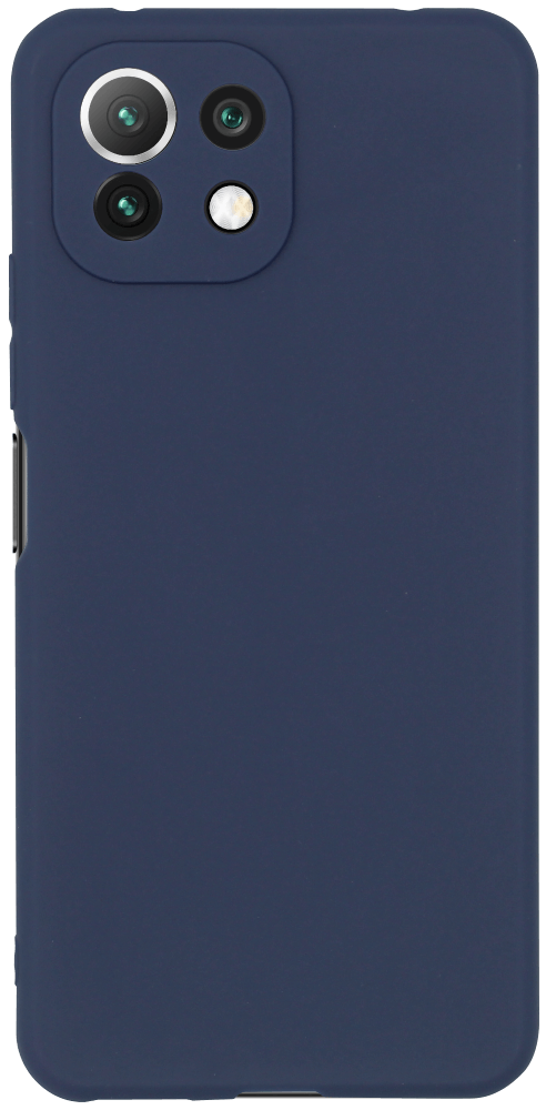 Xiaomi MI 11 Lite 5G szilikon tok kameravédővel matt sötétkék